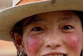 探究皮肤红血丝的成因及预防方法（揭开皮肤红血丝背后的秘密）
